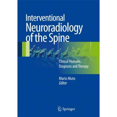 Imagem de Interventional Neuroradiology Of The Spine