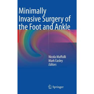 Imagem de Minimally Invasive Surgery of the Foot and Ankle