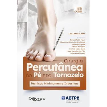 Imagem de Cirurgia Percutanea Do Pe E Do Tornozelo Tecn Minimamente Invasivas