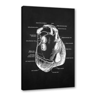 Imagem de Fundo preto anatomia humana arte médica impressões em tela imagens esqueleto músculo pôster vintage educação pintura arte decoração de parede (SKU11,40.6x50.8 cm = (40x50cm), emoldurado (tela embalada