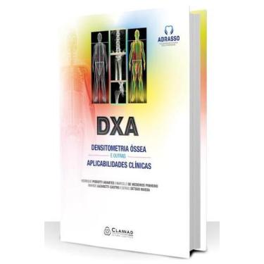 Imagem de Dxa densitometria ossea e outras aplicabilidades clinicas - EDITORA CL