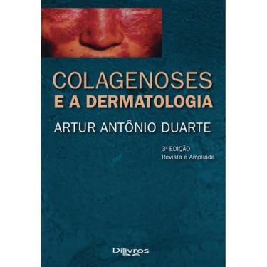 Imagem de Livro - Colagenoses E A Dermatologia - Duarte - Dilivros