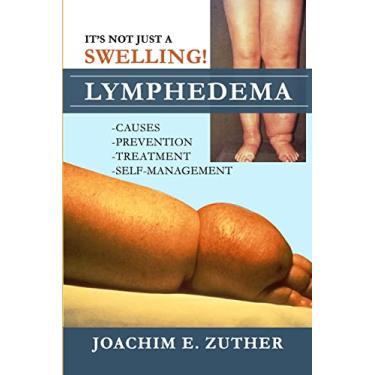 Imagem de It's Not Just a Swelling! Lymphedema: Causes, Prevention, Treatment, Self-Management
