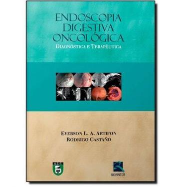 Imagem de Endoscopia Digestiva Oncologica