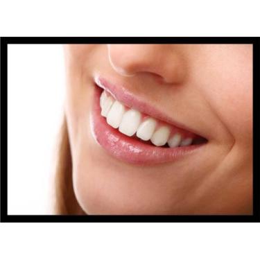 Imagem de Quadro Decorativo Dentista Consultórios Odontológicos Sorriso Dentes C