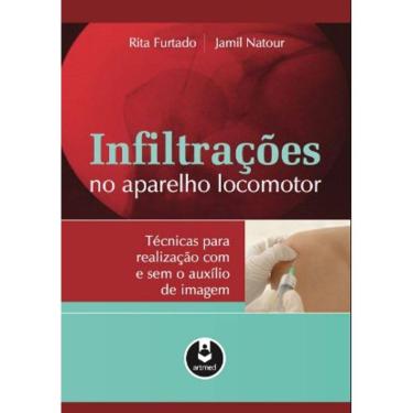 Imagem de Infiltracoes No Aparelho Locomotor - Tecnicas Para Realizacao Com E Sem O A