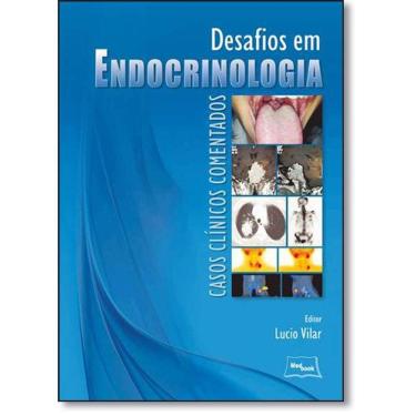 Imagem de Desafio Em Endocrinologia  - Casos Clinicos Comentados