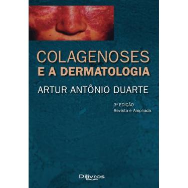 Imagem de Colagenoses e a dermatologia - DILIVROS