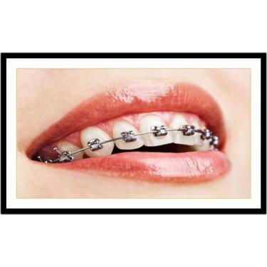 Imagem de Quadro Decorativo Dentista Dentes Aparelho Dentário Odontologia Consul