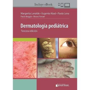 Imagem de Dermatologia Pediatrica  (espanhol)