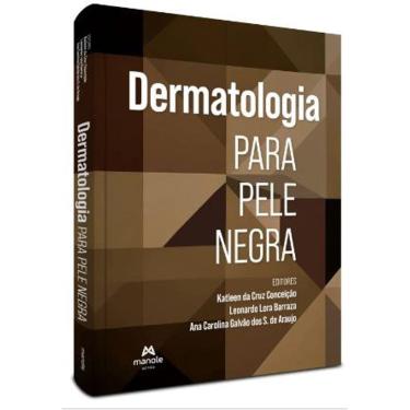Imagem de Dermatologia Para Pele Negra