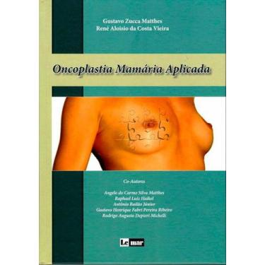 Imagem de Oncoplastia mamaria aplicada - I C DE SOUZA OLIVEIRA LIVRARIA ME