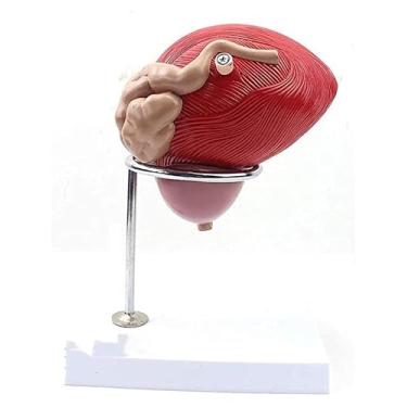 Imagem de Modelo de bexiga humana, modelo de próstata, anatomia do sistema urinário e reprodutivo, urologia, urologia e ensino para urologistas