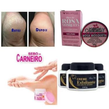 Imagem de Esfoliante corporal e rosto pele uniformizada Creme hidratante -kit mu
