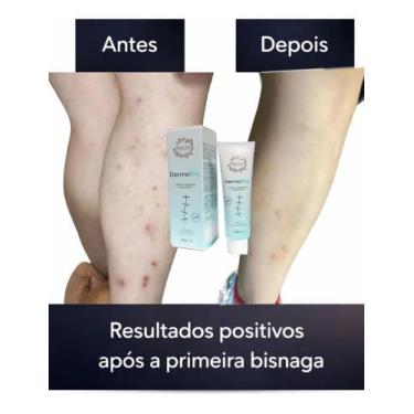 Imagem de Creme pomada Oleo de girassol tratamento de cicatrizes 20 g dermatriz