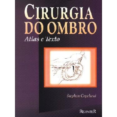 Imagem de Cirurgia Do Ombro Atlas E Texto