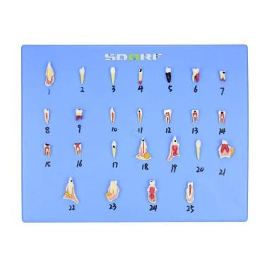 Imagem de Modelo de Patologias Dentárias em 25 Partes em Placa