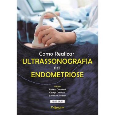 Imagem de Livro - Como Realizar Ultrassonografia Na Endometriose - Guerreiro - D