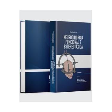 Imagem de Tratado de Neurocirurgia Funcional e Estereotaxica - Icm Publisher