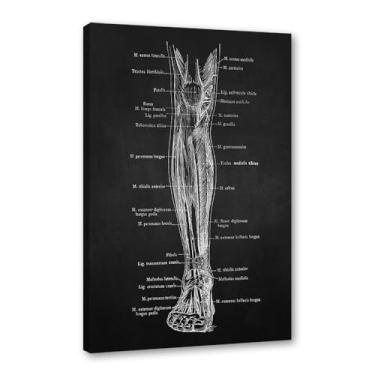 Imagem de Fundo preto anatomia humana arte médica impressões em tela imagens esqueleto músculo pôster vintage educação pintura arte decoração de parede (SKU5,20.3x30.5 cm = (20x30cm), emoldurado (tela embalada