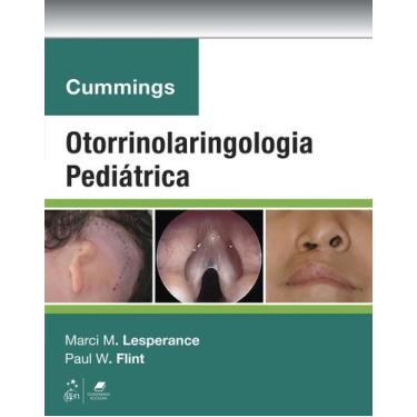 Imagem de Livro - Cummings Otorrinolaringologia Pediátrica