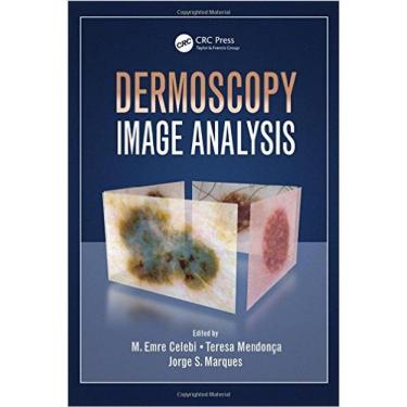 Imagem de Dermoscopy Image Analysis