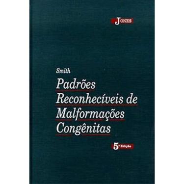 Imagem de Livro Smith Padrões Reconhecíveis De Malformações Congênitas