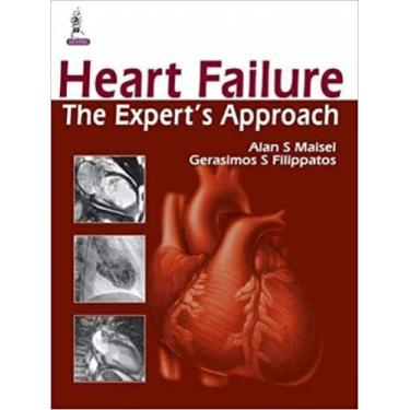 Imagem de Heart Failure The Experts Approach