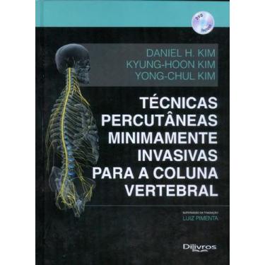 Imagem de Tecnicas percutaneas minimamente invasivas para coluna vertebral