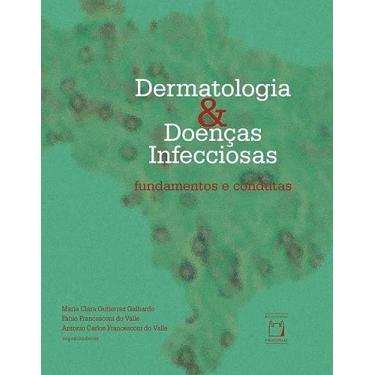 Imagem de Dermatologia e doenças infecciosas: fundamentos e condutas