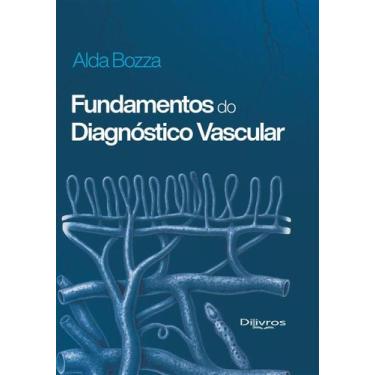 Imagem de Fundamentos Do Diagnóstico Vascular - DI LIVROS EDITORA LTDA