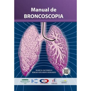 Imagem de Manual De Broncoscopia