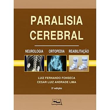 Imagem de Paralisia cerebral - Neurologia, ortopedia e reabilitação: Neurologia, Ortopedia, Reabilitação