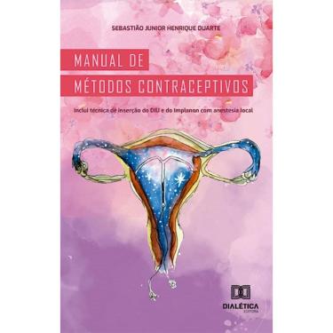 Imagem de Manual de métodos contraceptivos: inclui técnica de inserção do DIU e do Implanon com anestesia local