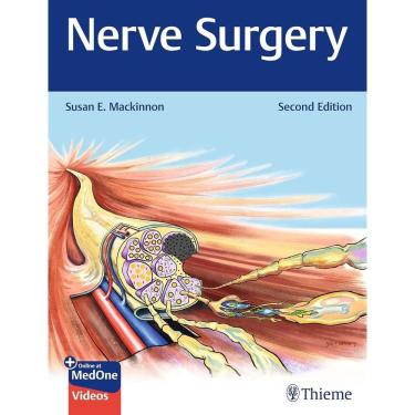 Imagem de Nerve Surgery
