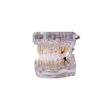 Imagem de Modelo odontológico de pediatria 5 anos dentição decídua - ROIC