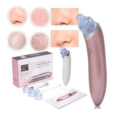 Imagem de Removedor de Cravos Extrator Sugador Espinhas Poros Cleaning Acne a Vácuo Elétrico Aparelho Sucção Dermobrasão Recarregável USB Portátil Peeling Limpeza Facial Aspirador Cuidados Rosto Nariz Máquina Espremedor Tirar Cravos FAZING (Rosa)