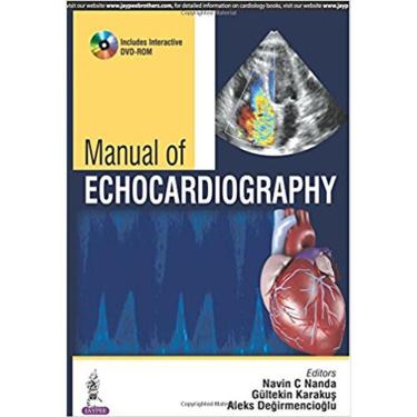 Imagem de Manual Of Echocardiography
