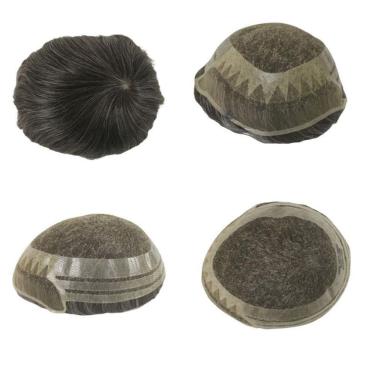 Imagem de Prótese Capilar Híbrida Mod. André Com Nó 20X25 D= 115%