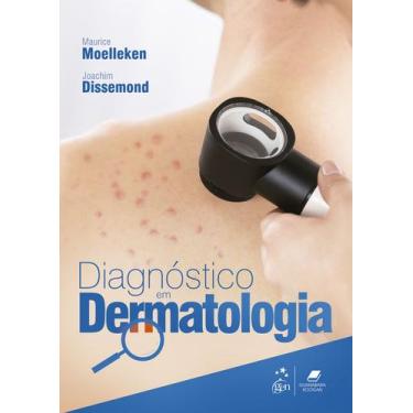 Imagem de Livro - Diagnóstico Em Dermatologia