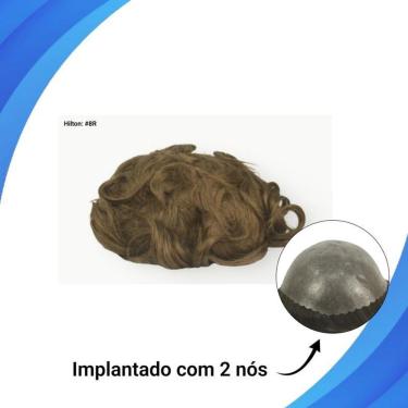 Imagem de Protese Capilar Micropele Hilton Tamanho 20X25 D=130%