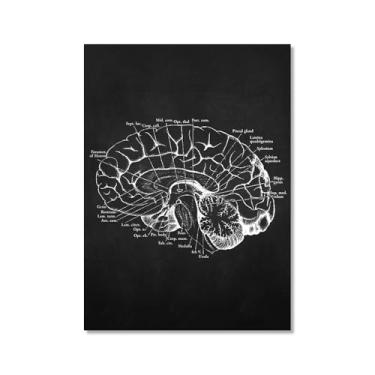 Imagem de Fundo preto anatomia humana arte médica impressões em tela imagens esqueleto músculo pôster vintage educação pintura arte decoração de parede (SKU9,30.5x40.6 cm = (30x40 cm), sem moldura)