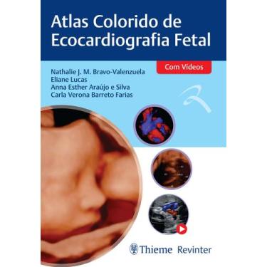 Imagem de Livro - Atlas de Ecocardiografia Fetal