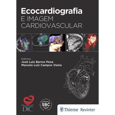 Imagem de Ecocardiografia e imagem cardiovascular