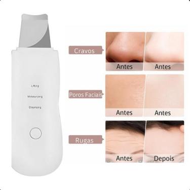 Imagem de Aparelho de Ultrassom para Cuidados Faciais e Tira Cravos - ASAF