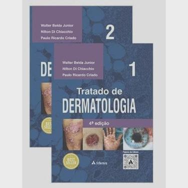 Imagem de Livro: Tratado De Dermatologia 2 Volumes - 4ª Edição - Walter Belda Jr, Paulo Ricardo Criado E Nilton Di Chiacchio