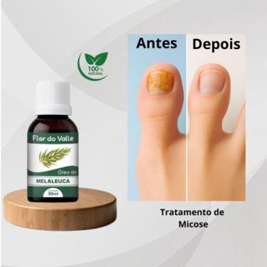 Imagem de Óleo Vegetal De Melaleuca 30ml Flor Do Valle - Essencial - Flor da val