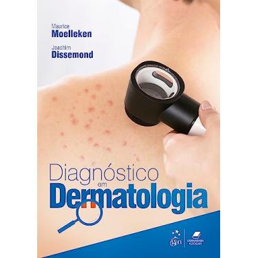 Imagem de Diagnóstico Em Dermatologia