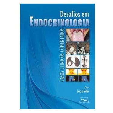 Imagem de Livro - Desafios em Endocrinologia: Casos Clínicos Comentados - Lucio Vilar