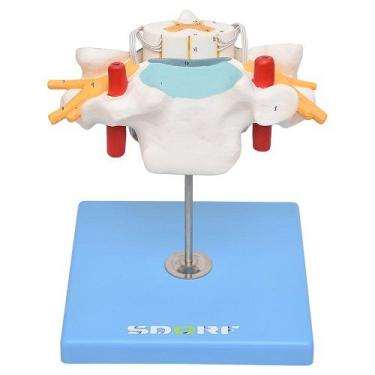 Imagem de Vértebra Cervical C/cordão Espinhal Modelo Anatomia